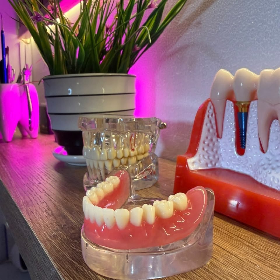 Modelo de prótesis e implante dental de Sabogal Dental