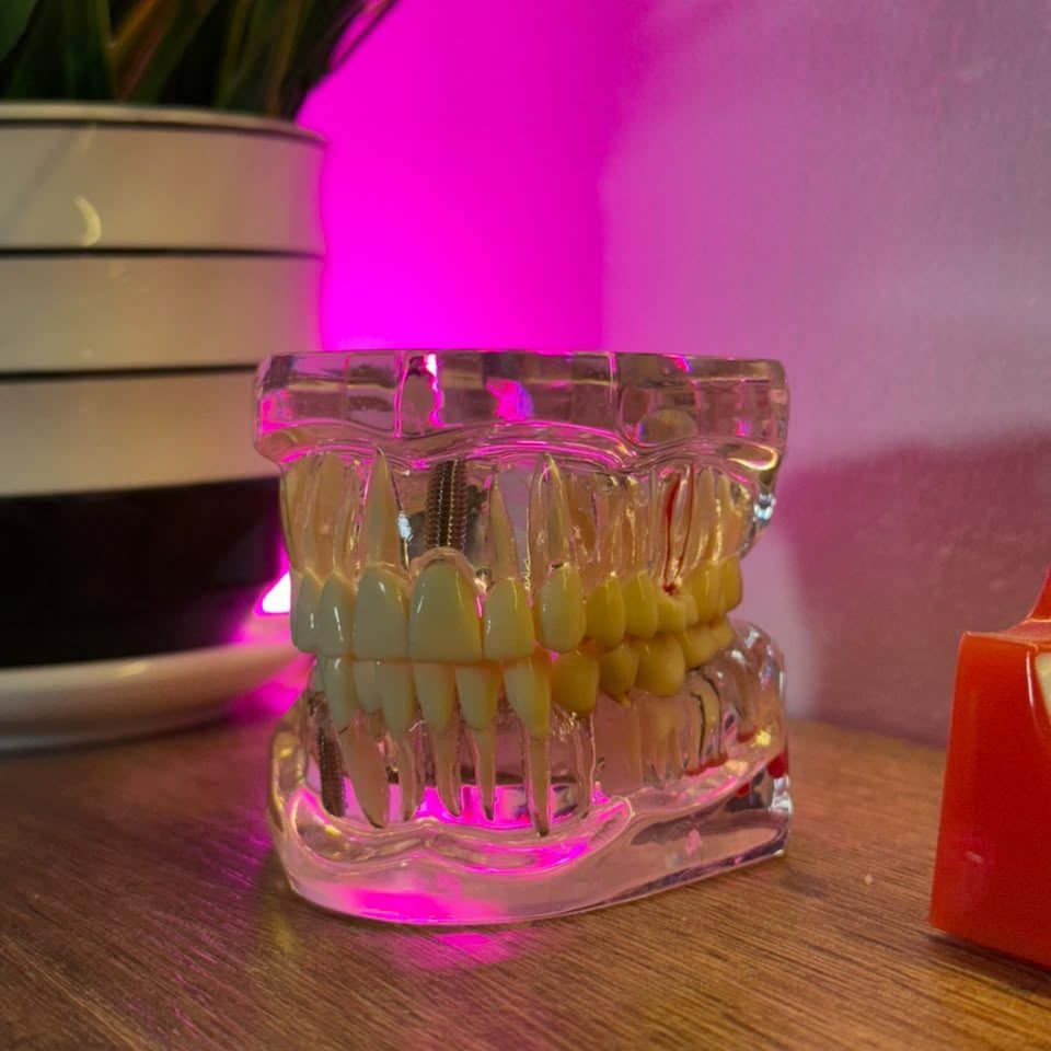 Modelo dental transparente en el laboratorio de Sabogal Dental