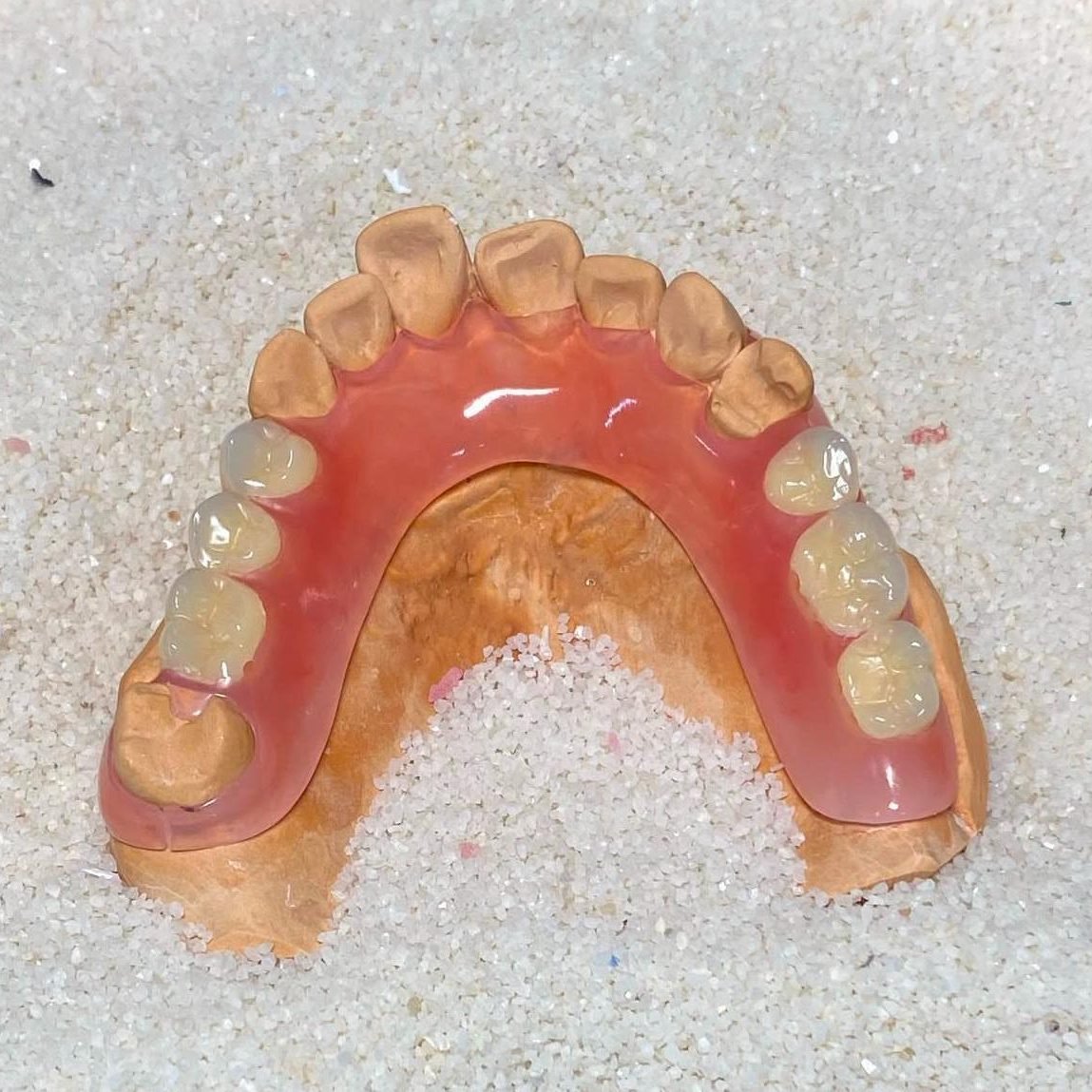 Prótesis total inferior fabricada por Sabogal Dental